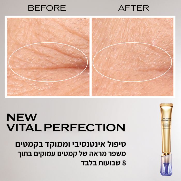 Intensive WrinkleSpot Treatment